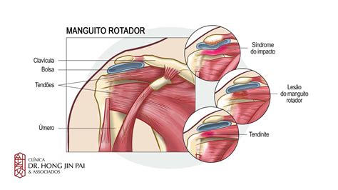 Pin em Corpo humano