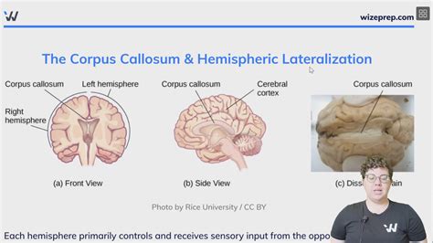 The Corpus Callosum & Hemispheric Lateralization - Wize University ...