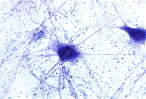 Human Nerve Cells Under Microscope