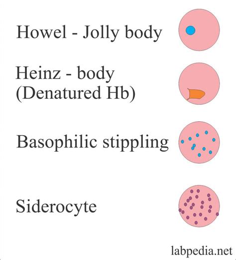 Red Blood Cell (RBC) – Part 2 – Peripheral Blood Smear Interpretations ...