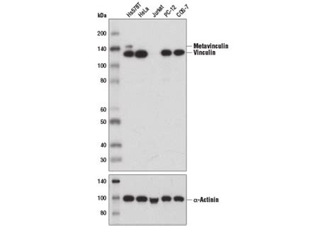 Vinculin (E1E9V) XP® Rabbit mAb | Cell Signaling Technology