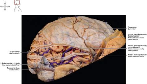 Meninges Of The Brain And Spinal Cord Spinal Cord Anatomy Spinal | My ...