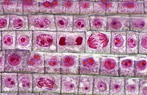 Onion Root Tip Mitosis - LiliaqoBenton