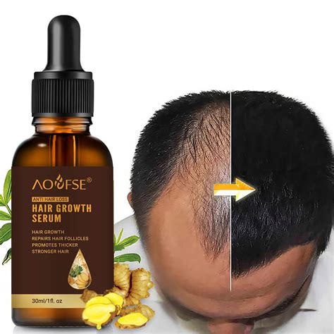 Women Anti Hair Loss Boosting Hair Growth Oil Natural Ginger Men Hair ...