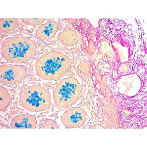 Colloidal Iron Stain Kit, Modified Müller-Mowry, Volume Optimized | Cancer Diagnostics Inc.