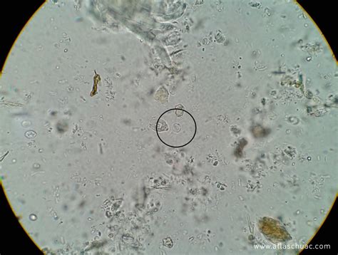 Blastocystis hominis – LaboATLAS