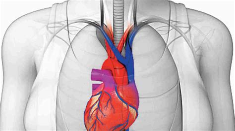 Dextrocardia types, dextrocardia situs inversus, causes, symptoms, ECG & complications