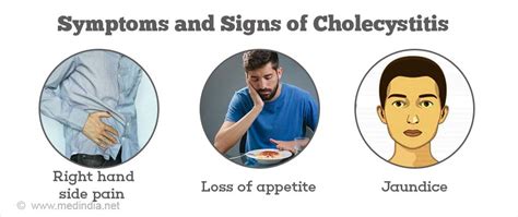 Cholecystitis | Inflammation of the Gall Bladder - Causes, Symptoms, Treatment, Diagnosis and ...