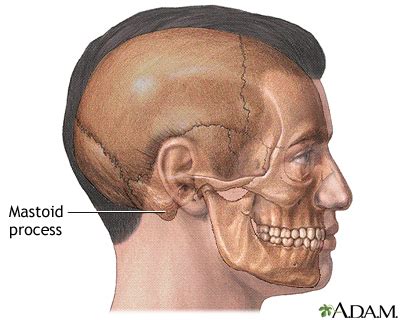 Mastoidectomy - series—Normal anatomy: MedlinePlus Medical Encyclopedia