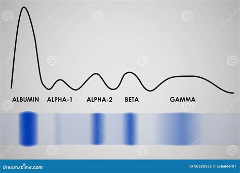 Blood Serum Protein Electrophoresis Stock Vector - Image: 56526532