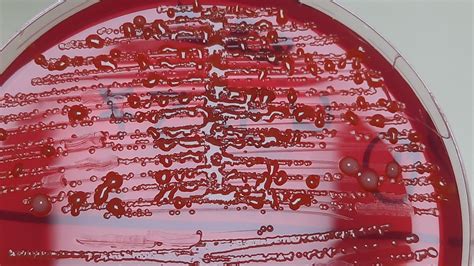 Serratia Archives - Medical Notes