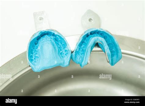 Dental alginate impression hi-res stock photography and images - Alamy