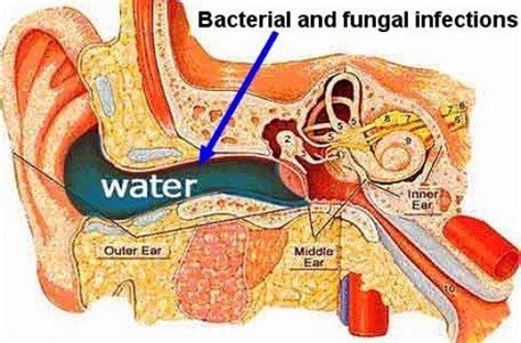 Swimmers Ear: Symptoms, Remedy and Treatment