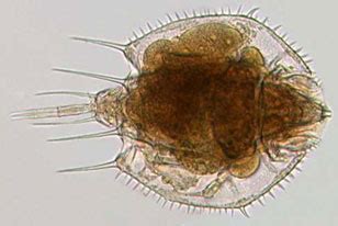 PHYLUM ROTIFERA - ANIMAL CLASSIFICATION PROJECTMAX MANZANARES - HONORS BIOlogy MAY 2015