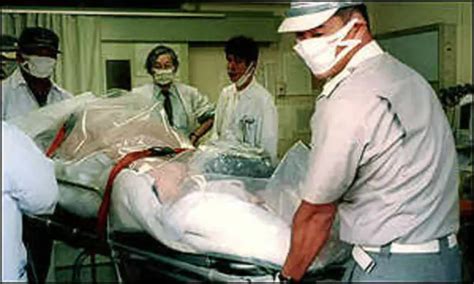 Hisashi Ouchi, the Victim of Fatal Radiation Kept Alive for 83 Days