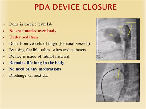 PDA Management - Dr. Gaurav Agrawal