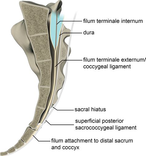 Imaging Coccygeal Trauma and Coccydynia | RadioGraphics