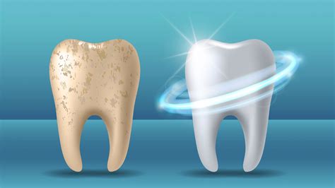 Can Damaged Tooth Enamel Be Repaired? - Affinity Dental