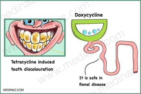 Tetracycline Antibiotics: Uses, mechanism of action, side-effects - Medinaz