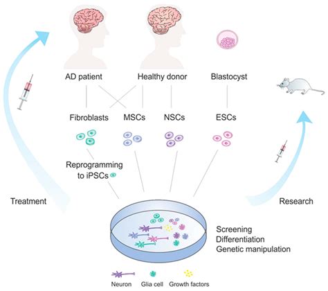 IJMS | Free Full-Text | Neurodegeneration and Neuro-Regeneration—Alzheimer’s Disease and Stem ...