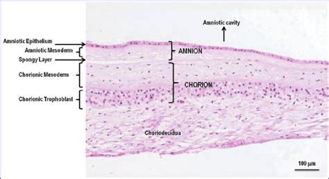 Human amnion and chorion microscopic structure. The amnion is composed ...