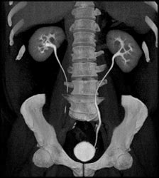 slsi.lk - how long for sulfatrim to work | Are not can a ct urogram show the pancreas opinion