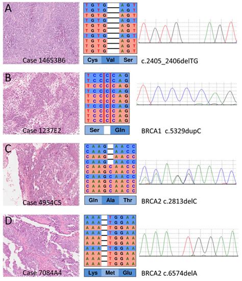 BRCA somatic and germline mutation detection in paraffin embedded ...