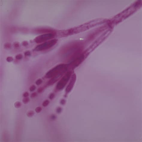 Penicillium Microscope Slides | Carolina.com