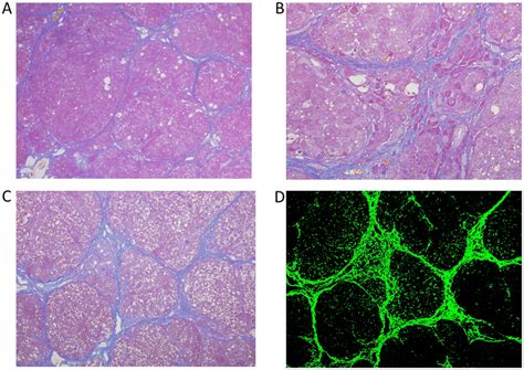 Liver fibrosis in CCl 4-treated rats. On the 5 th week, histological ...