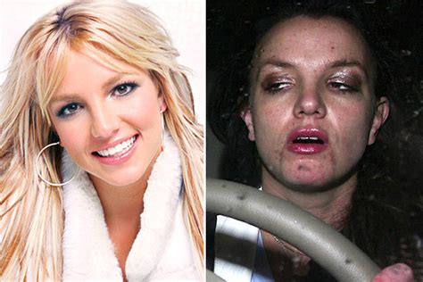 You Won’t Believe These Photos of 20 Celebrities Before and After Drugs – POP Hitz - Celebrity ...