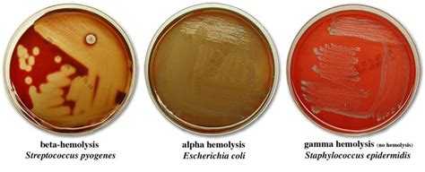 Beta, alpha, and gamma hemolysis | Mikrobiyoloji