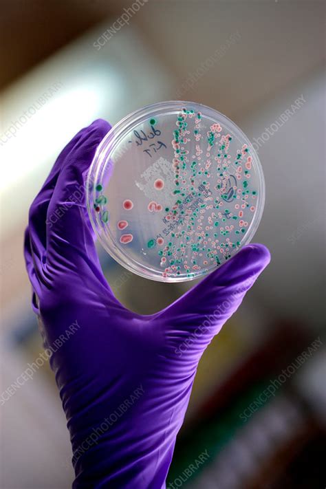 Fungi culture - Stock Image - C031/0322 - Science Photo Library