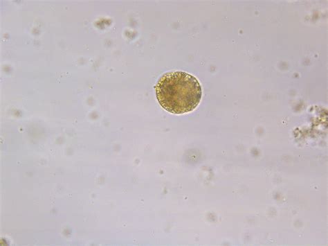 Can anyone help me to identify this marine phytoplankton species?