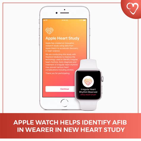 Apple Watch helps Identify AFib in Wearer in New Heart Study - CardioVisual - Heart and Diabetes ...