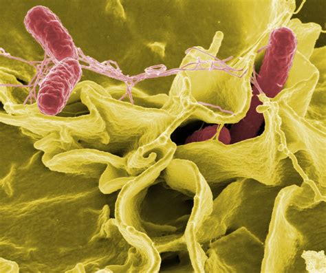 Salmonella Bacteria | Salmonella bacteria (pink), a common c… | Flickr