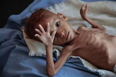 85,000 children in Yemen have starved to death: Save the Children ...