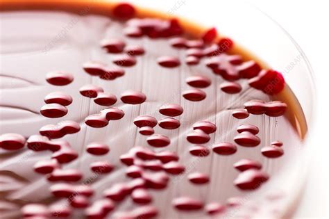 Serratia marcescens culture - Stock Image - C036/9183 - Science Photo ...