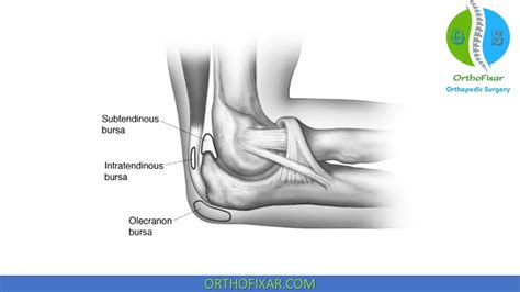 Elbow (Olecranon) Bursitis: Symptoms, Causes Treatment, 55% OFF