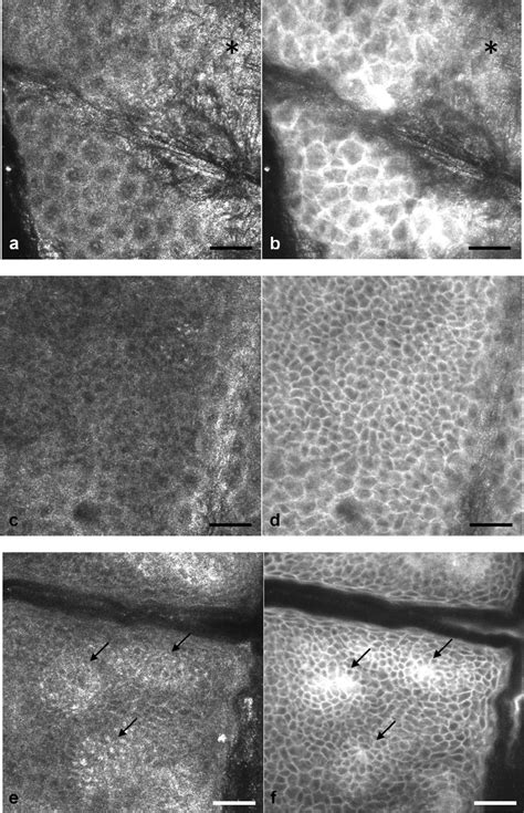 (a) RM image of the stratum granulosum 5 μm below the skin surface. (b)... | Download Scientific ...