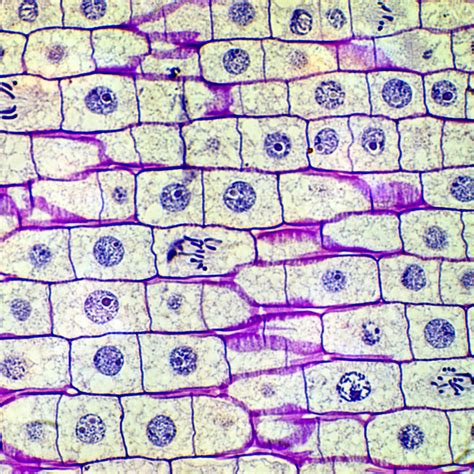 Squash an Onion and Learn the True Age of Your Cells | Mitosis ...