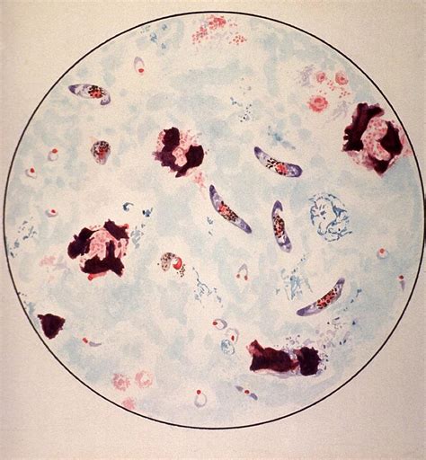 Microscopic View Of A Malaria Parasite Photograph by Everett