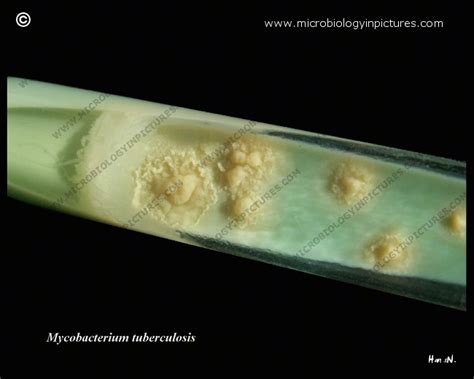 Mycobacterium Tuberculosis Culture Media