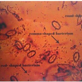 Direct count of the different morphotypes of bacteria colonizing the 1... | Download Scientific ...