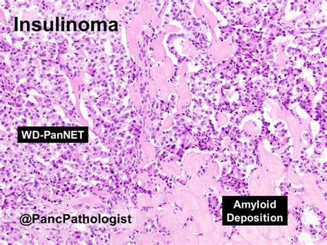 Webpathology.com: A Collection of Surgical Pathology Images