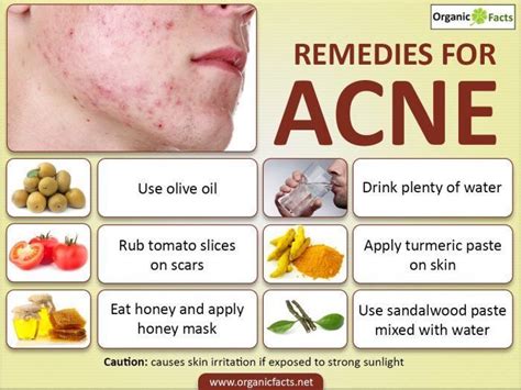 Pin on Oily Skin And Acne