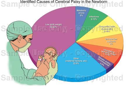 Cause of Spastic Paralysis - Dealing with Spastic Paralysis (Cerebral Palsy)