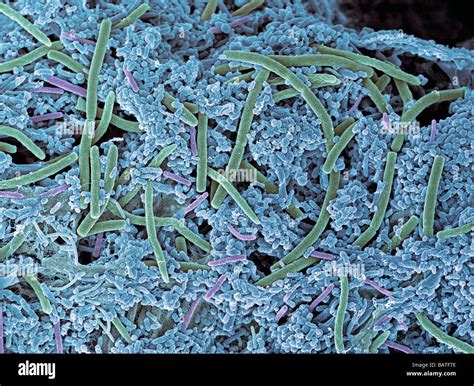 Dental plaque, coloured scanning electronmicrograph (SEM). Plaque consists of bacteria embedded ...