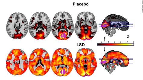 This is your brain on LSD, literally - CNN