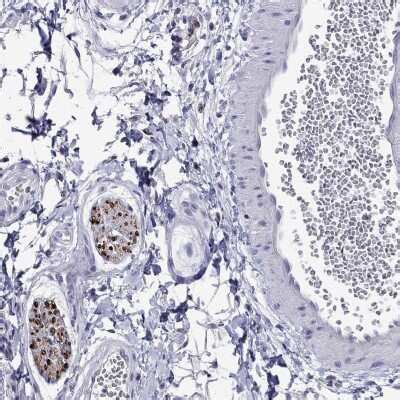 Myelin Protein Zero Antibodies: Novus Biologicals