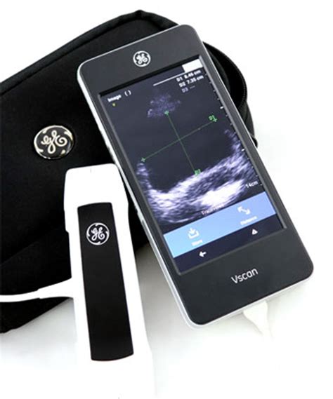 GE Vscan Extend R2 with Dual Probe Ultrasound System